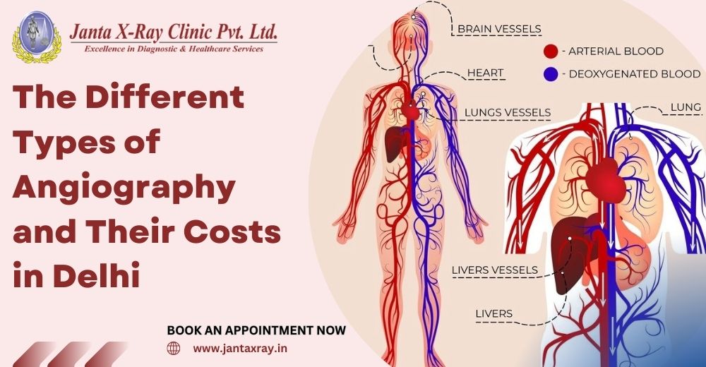 The Different Types of Angiography and Their Costs in Delhi